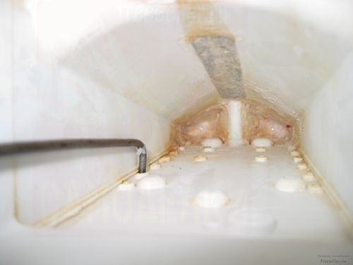 Приспособление для чистки стиральной машины