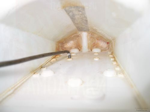 Приспособление для чистки стиральной машины