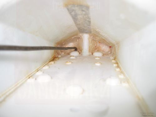 Приспособление для чистки стиральной машины